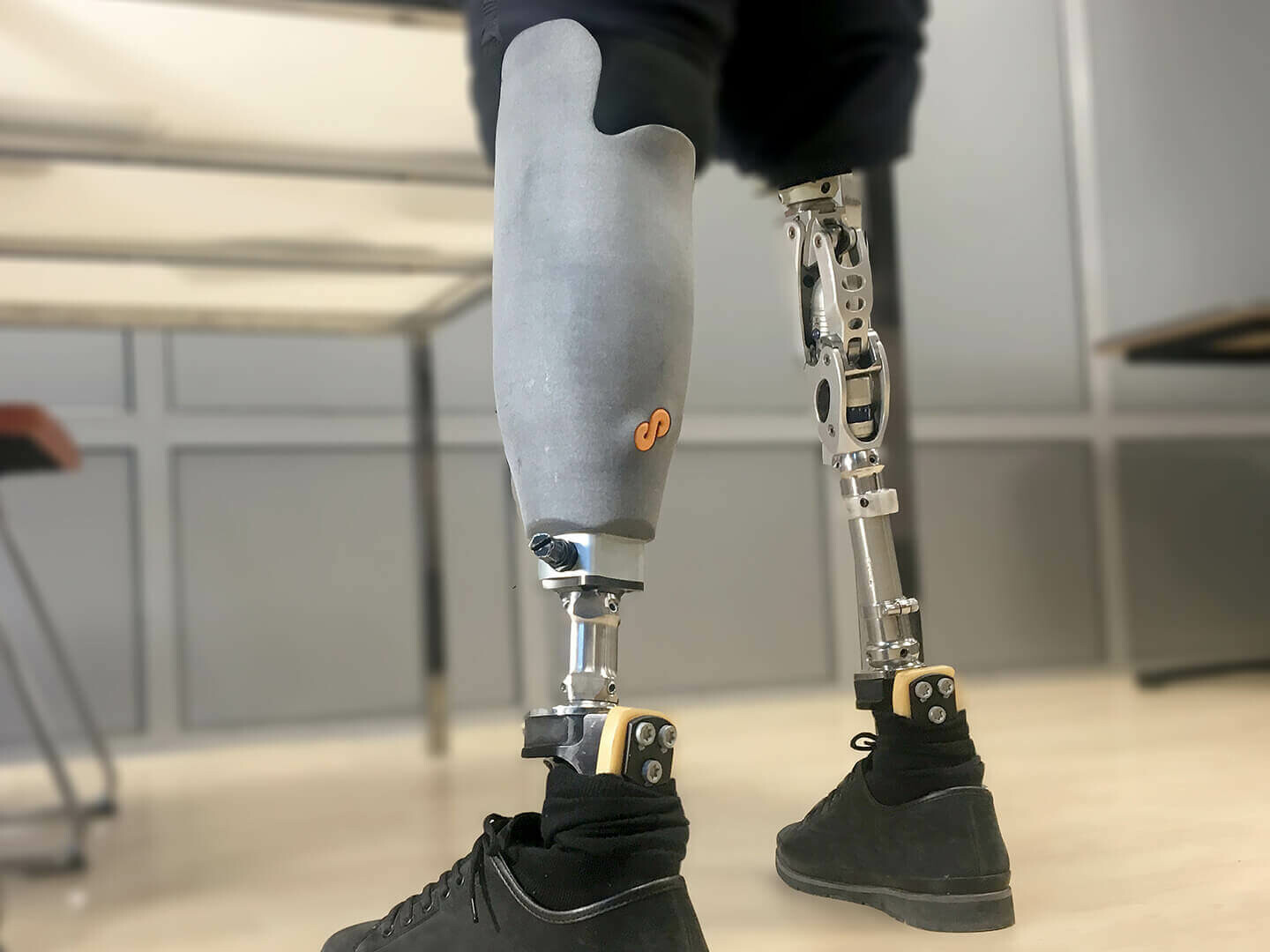 Prosthetic Socket