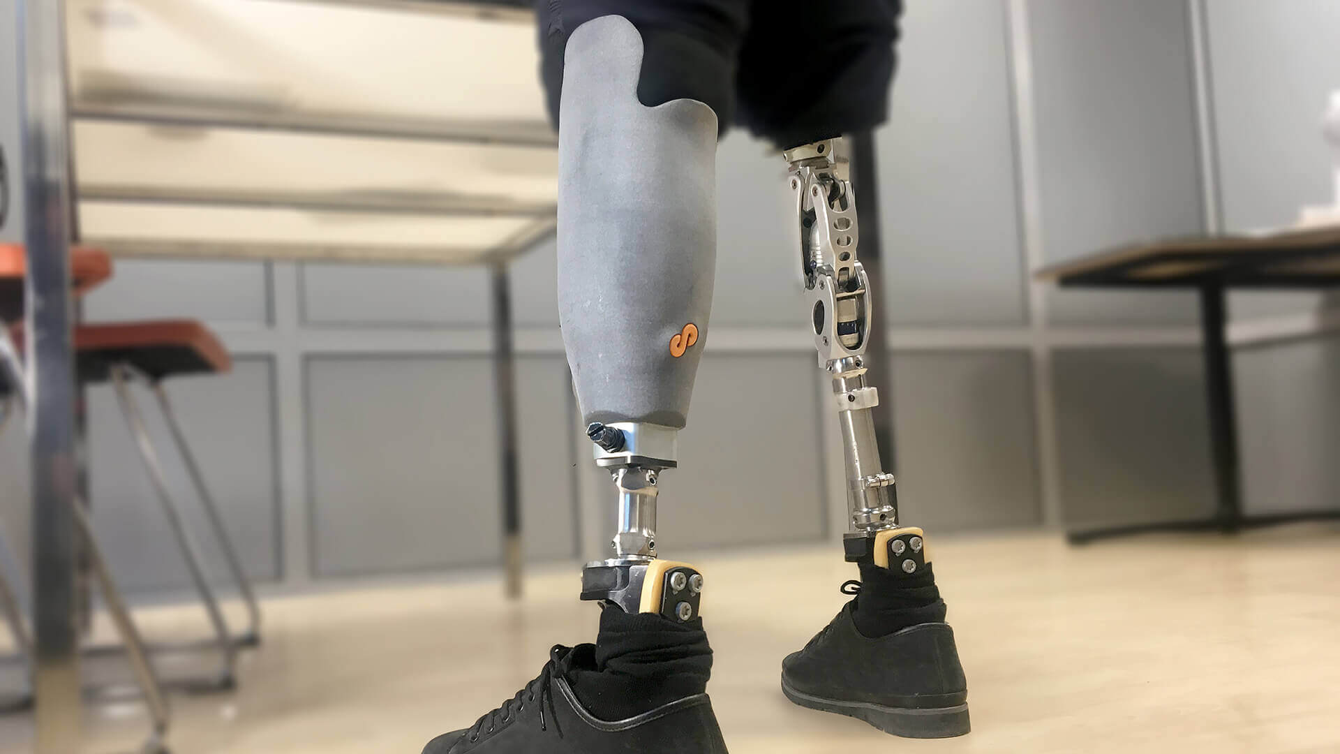 Prosthetic Socket